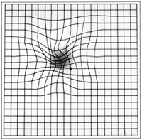 Amsler Grid with AMD