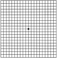 Normal Amsler Grid