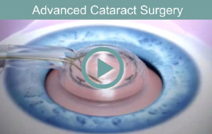 advanced-cataract-surgery-with-zepto-fi
