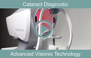 cataract-diagnostic-tech-th